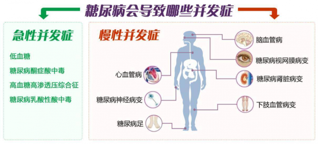 糖尿病患者一定要定期检查的几个项目
