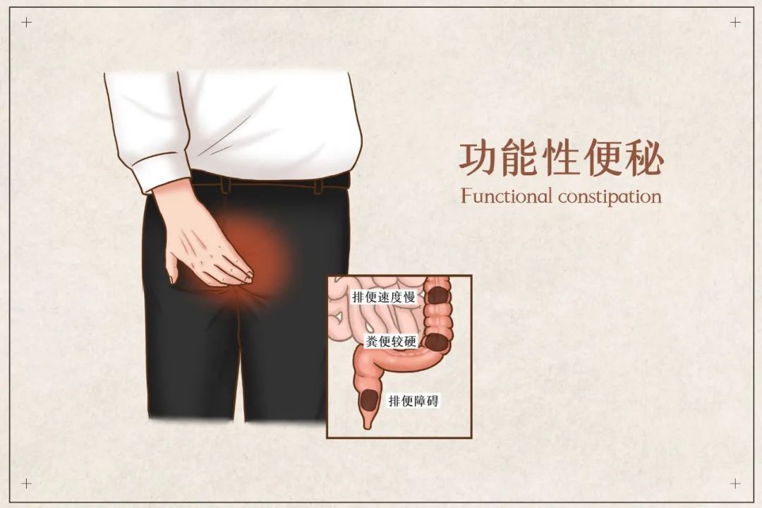 02大便通，激肾气