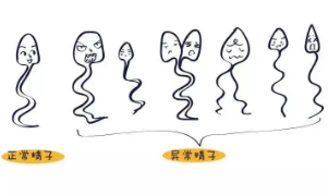 憋精忍一时，精子毁一世