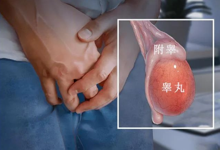 警惕蛋蛋过大或过小